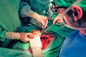 transplantation-d-organe
